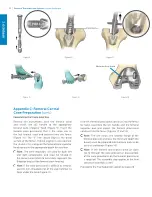Предварительный просмотр 58 страницы Zimmer Biomet Persona Surgical Technique