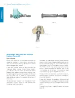 Предварительный просмотр 62 страницы Zimmer Biomet Persona Surgical Technique