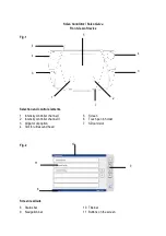 Preview for 3 page of Zimmer Soleo SonoStim Operating Instructions Manual