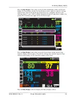 Preview for 51 page of ZOLL Propaq M Operator'S Manual