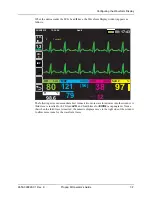 Preview for 53 page of ZOLL Propaq M Operator'S Manual