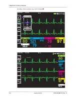 Preview for 54 page of ZOLL Propaq M Operator'S Manual