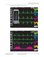 Preview for 55 page of ZOLL Propaq M Operator'S Manual