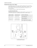 Preview for 74 page of ZOLL Propaq M Operator'S Manual