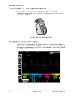 Preview for 76 page of ZOLL Propaq M Operator'S Manual