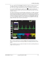 Preview for 77 page of ZOLL Propaq M Operator'S Manual