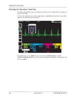 Preview for 78 page of ZOLL Propaq M Operator'S Manual