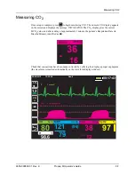 Preview for 113 page of ZOLL Propaq M Operator'S Manual