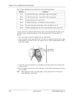 Preview for 156 page of ZOLL Propaq M Operator'S Manual