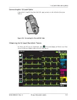 Preview for 157 page of ZOLL Propaq M Operator'S Manual