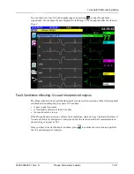 Preview for 161 page of ZOLL Propaq M Operator'S Manual