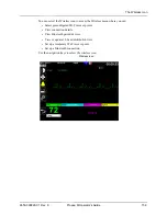 Preview for 173 page of ZOLL Propaq M Operator'S Manual